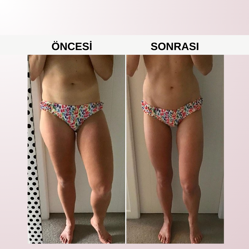 Selülit Giderici Masaj Aleti