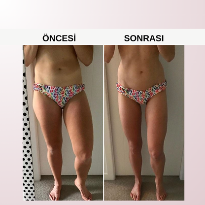 Selülit Giderici Masaj Aleti