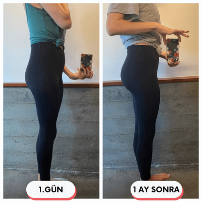 Kalça Sıkılaştırıcı