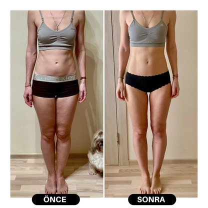 Ems karın şekillendirici